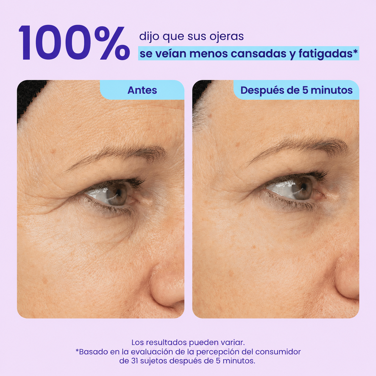 GEL CONTORNO DE OJOS DE EFECTO LIFTING INSTANTÁNEO