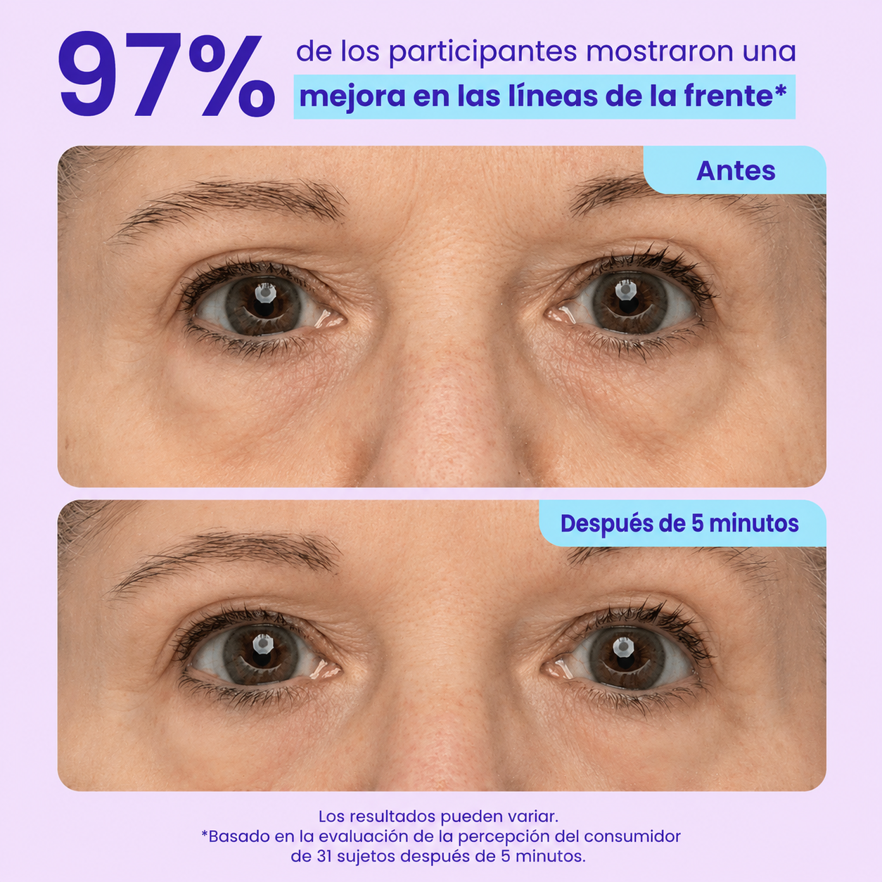 GEL CONTORNO DE OJOS DE EFECTO LIFTING INSTANTÁNEO